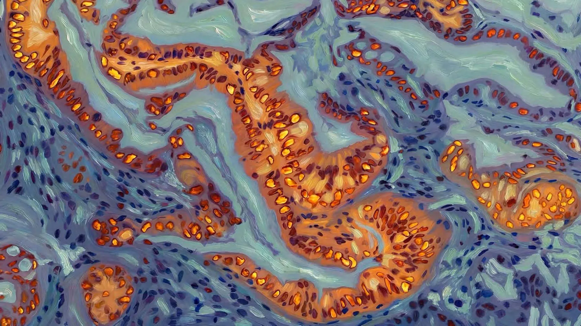 Vědci objevili genetický přepínač, který způsobuje rezistenci rakoviny slinivky na chemoterapii