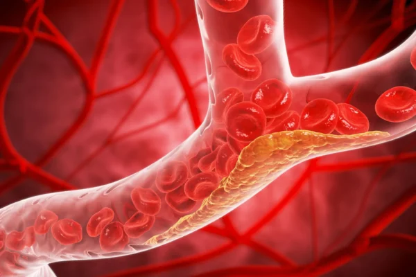Nová pilulka snižuje „špatný“ cholesterol o 60 % v hlavní studii