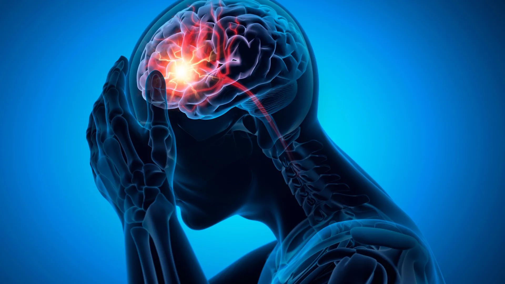 165 000 pacientů s demencí odhaluje skryté riziko mrtvice z běžného léku