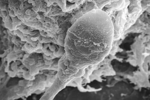 Ztraceni ve vesmíru: Mikrogravitace způsobuje, že spermie ztrácejí orientaci