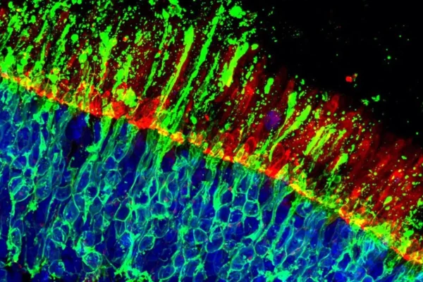 Průlom může chránit buňky zraku, které umožňují vidět tváře a barvy