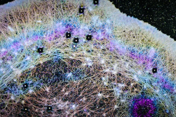 Vědci objevili skryté „větry“ uvnitř buněk, které by mohly vysvětlit šíření rakoviny