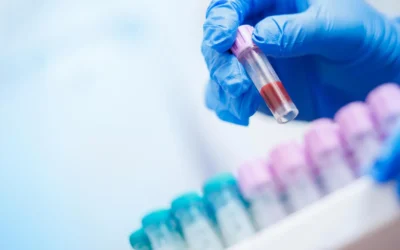 Jednoduchý krevní test by mohl odhalit riziko Alzheimerovy choroby roky předem